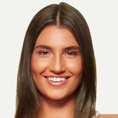 🔥Last Day:78% Off🔥Hairline Topper- Clip Free