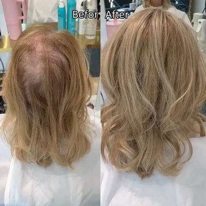 ⚡ Final Hours –💥2026 New Lightweight & Breathable Wavy Hair Topper